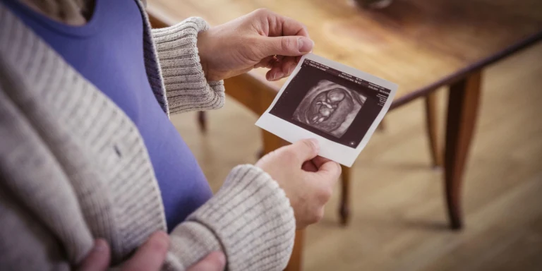 Schwangere Frau hält ein Ultraschall-Bild in der Hand