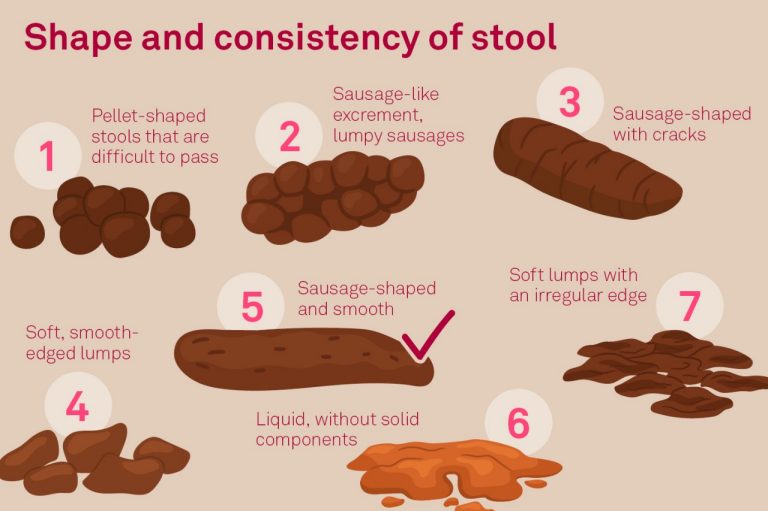 Shape and consistency of stool